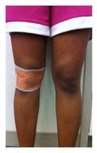 Comparativa entre kinesiotaping y vendaje mc connell dolor anterior de rodilla